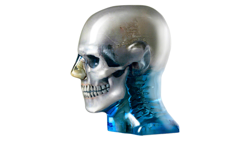 <span style="color:;font-weight:normal;">711-HN头部模体</span>